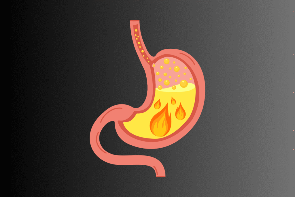 Acidityi Acidity Ayurveda: Types, Causes, Symptoms & Treatment