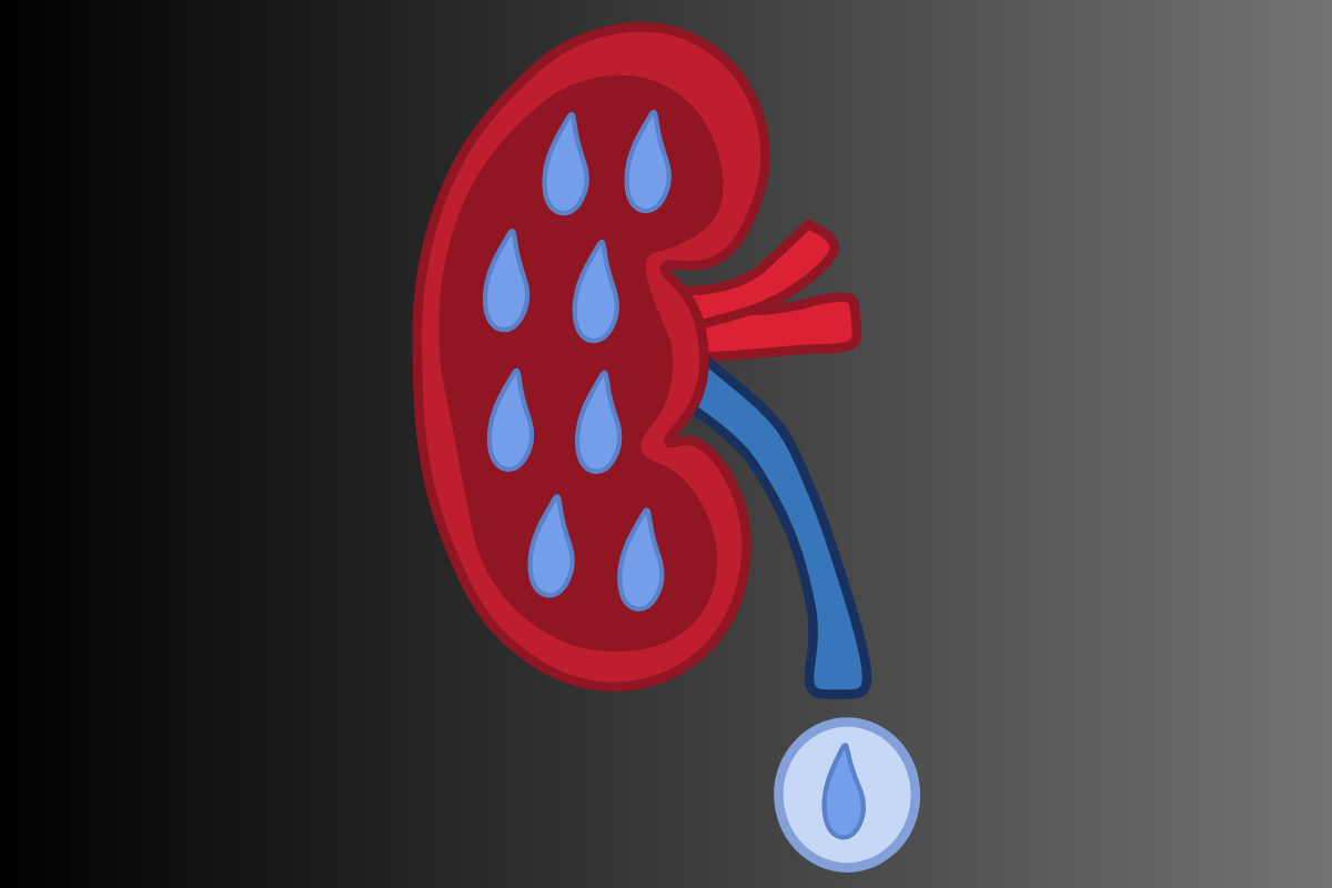 Diabetic Nephropathy