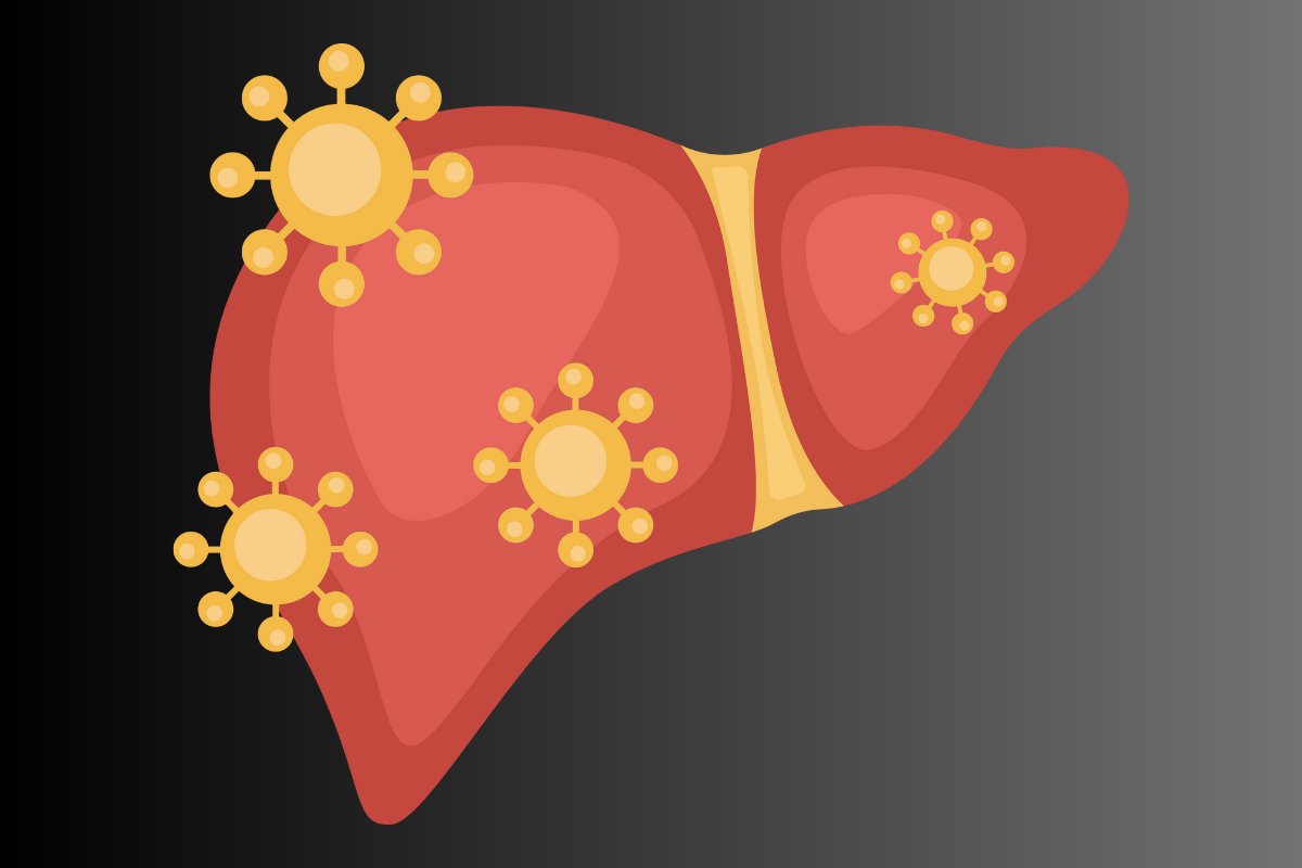Gilbert’s Syndrome