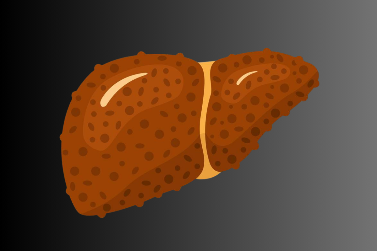 Liver Cirrhosis