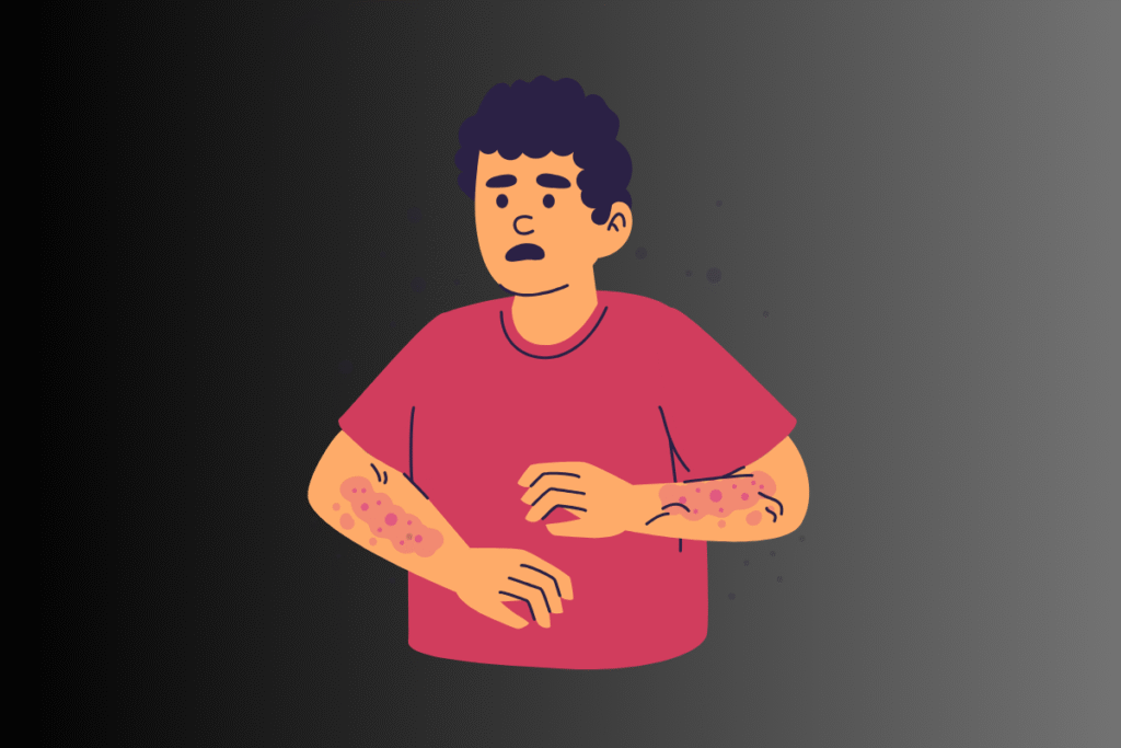Skin Rashes Ayurveda: Types, Causes, Symptoms & Treatment